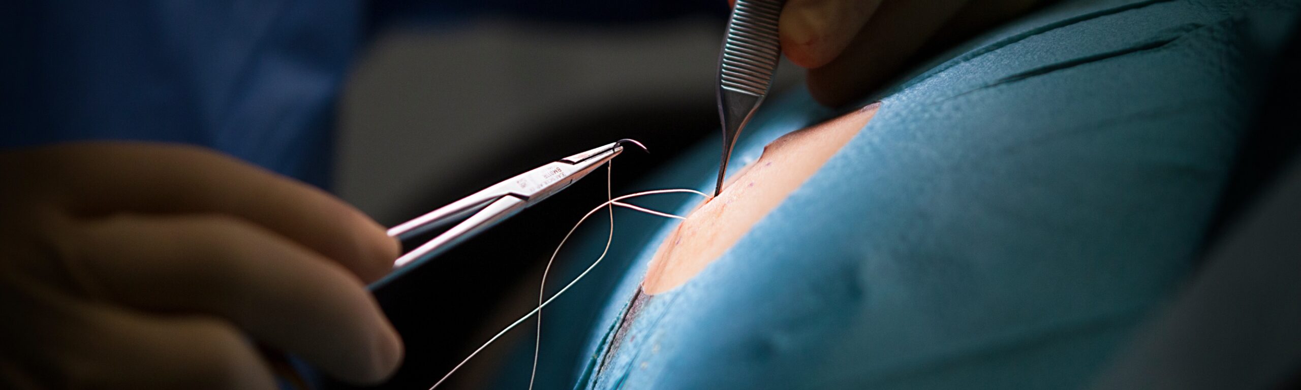 Prise en charge de la chirurgie dermatologique | Chirurgien dermatologue | Maison Abeille | Paris 16